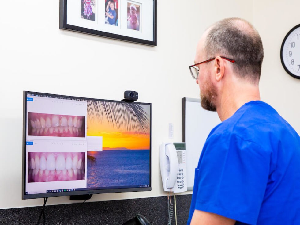 Cosmetic Dentist Mackay Cosmetic Dentistry Services Mount Pleasant