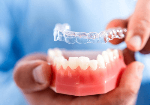 What Are The Pros and Cons of Braces Vs Invisalign - Mackay - Plaza Dental