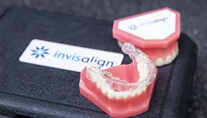 Clear Aligners