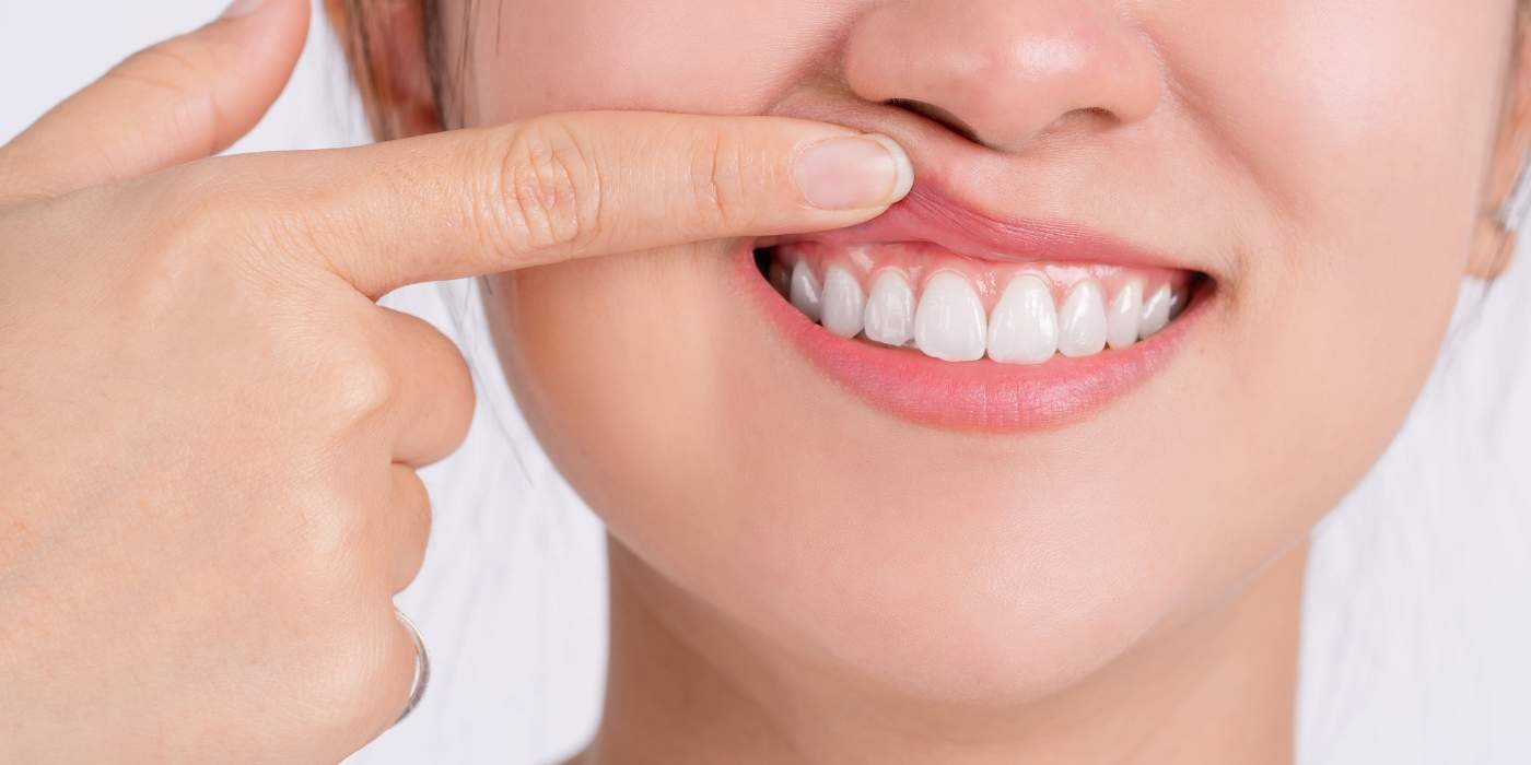 Copper Nanodots & Ionic Gel: Fighting Gum Disease Sci-Fi Style